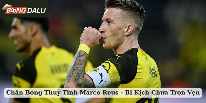 chân bóng thuỷ tinh Marco Reus